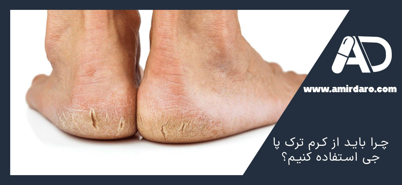 چرا باید از کرم ترک پا جی استفاده کنیم؟
