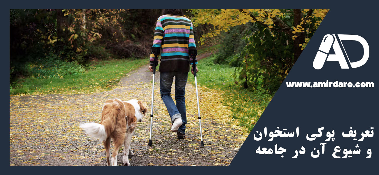 تعریف پوکی استخوان و شیوع آن در جامعه