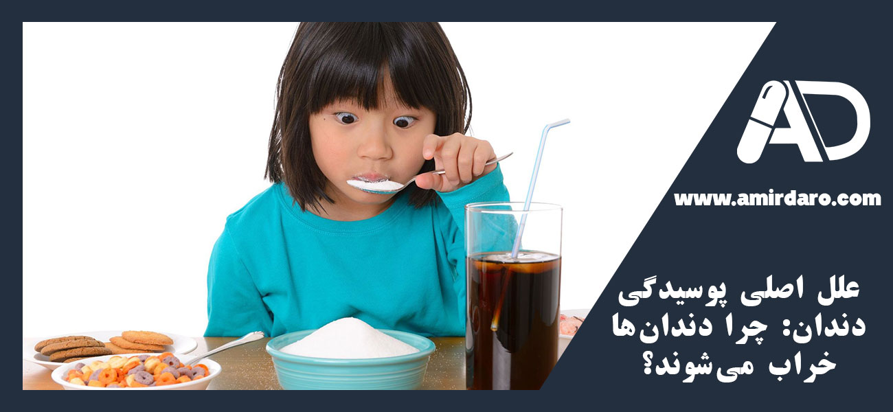 علل اصلی پوسیدگی دندان: چرا دندانها خراب میشوند؟