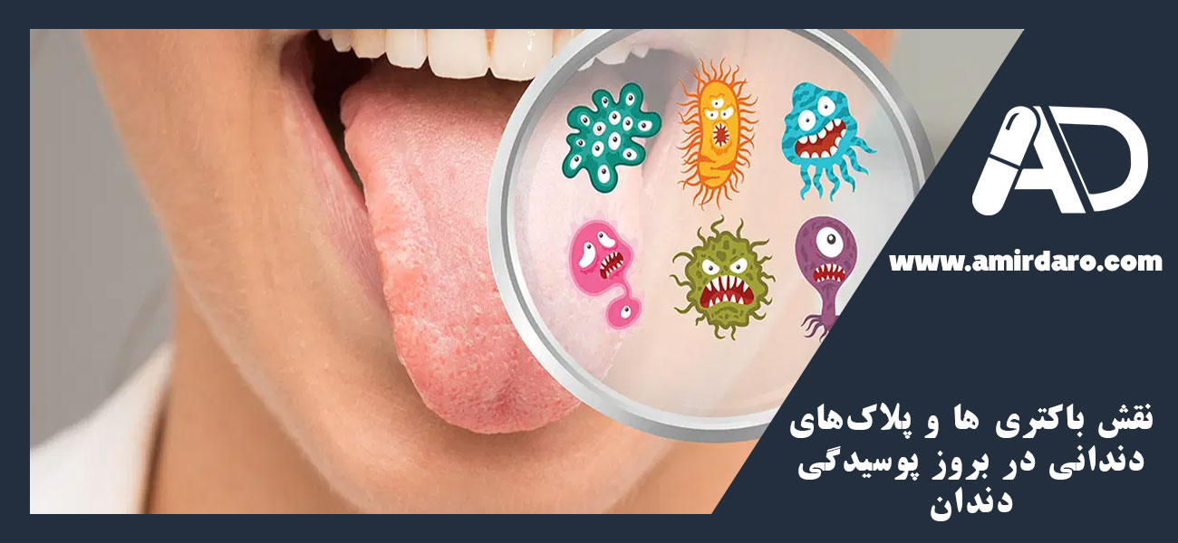 نقش باکتری ها و پلاکهای دندانی در بروز پوسیدگی دندان