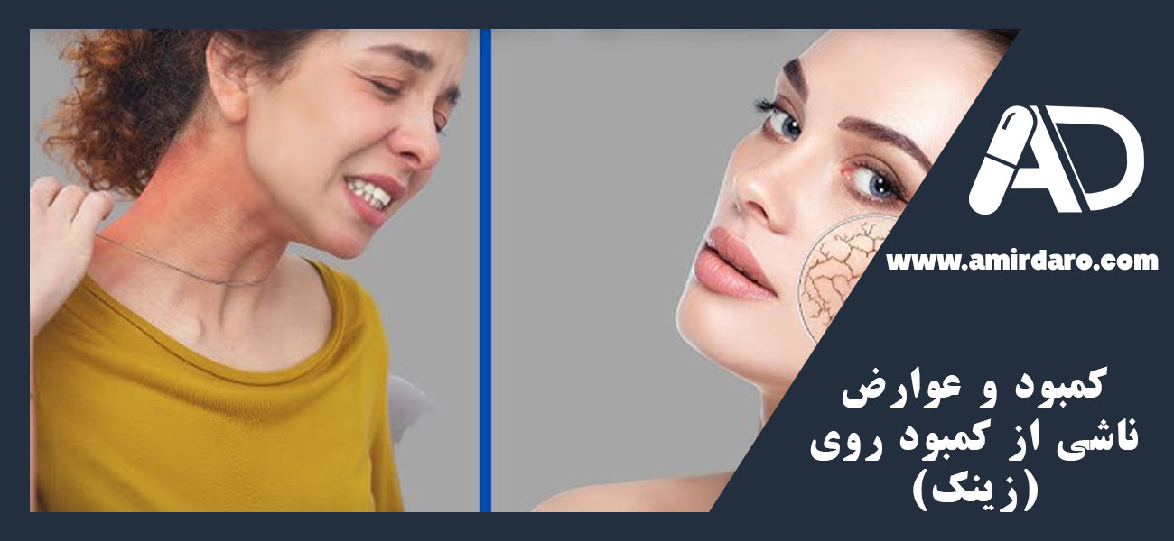 کمبود و عوارض ناشی از کمبود روی (زینک)