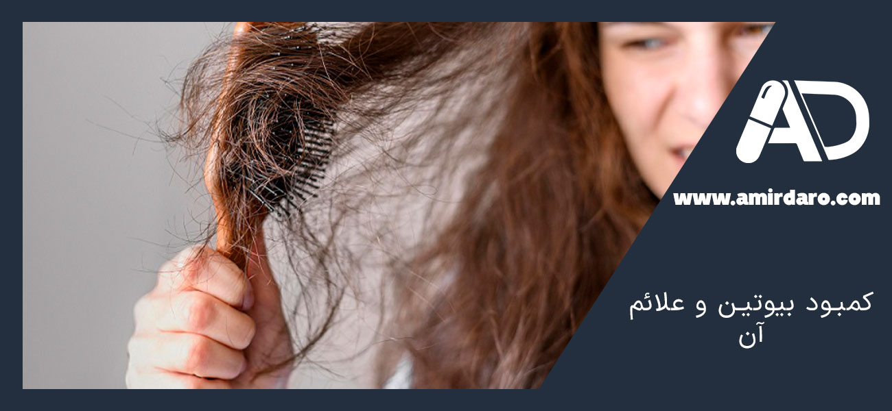 کمبود بیوتین و علائم آن