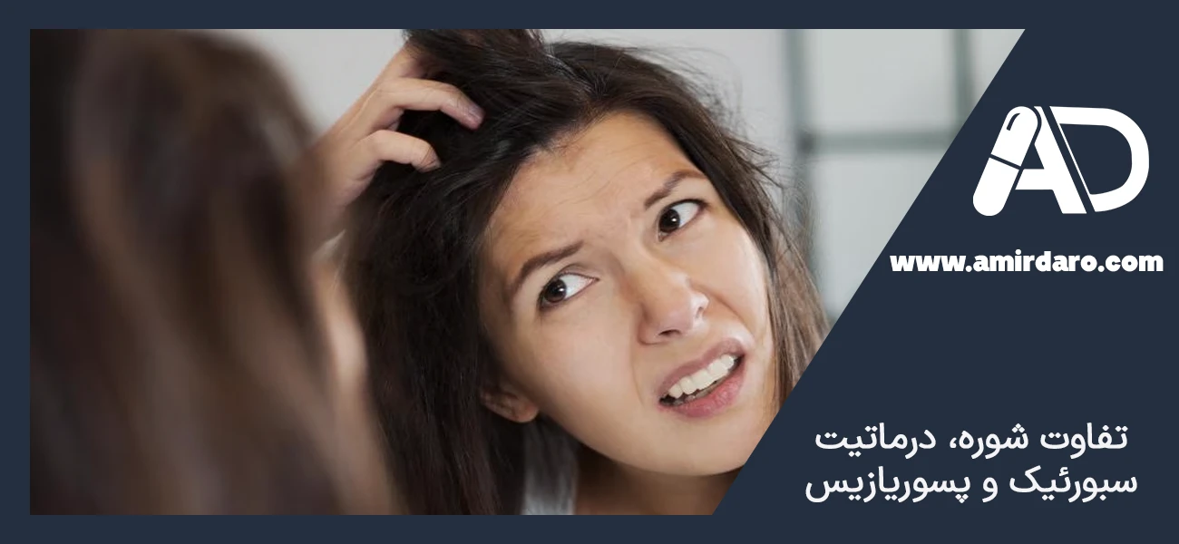 تفاوت شوره، درماتیت سبورئیک و پسوریازیس