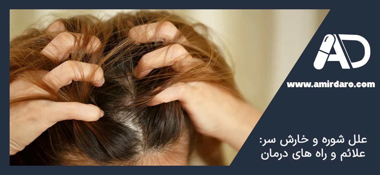 علل شوره و خارش سر: علائم و راه‌ های درمان