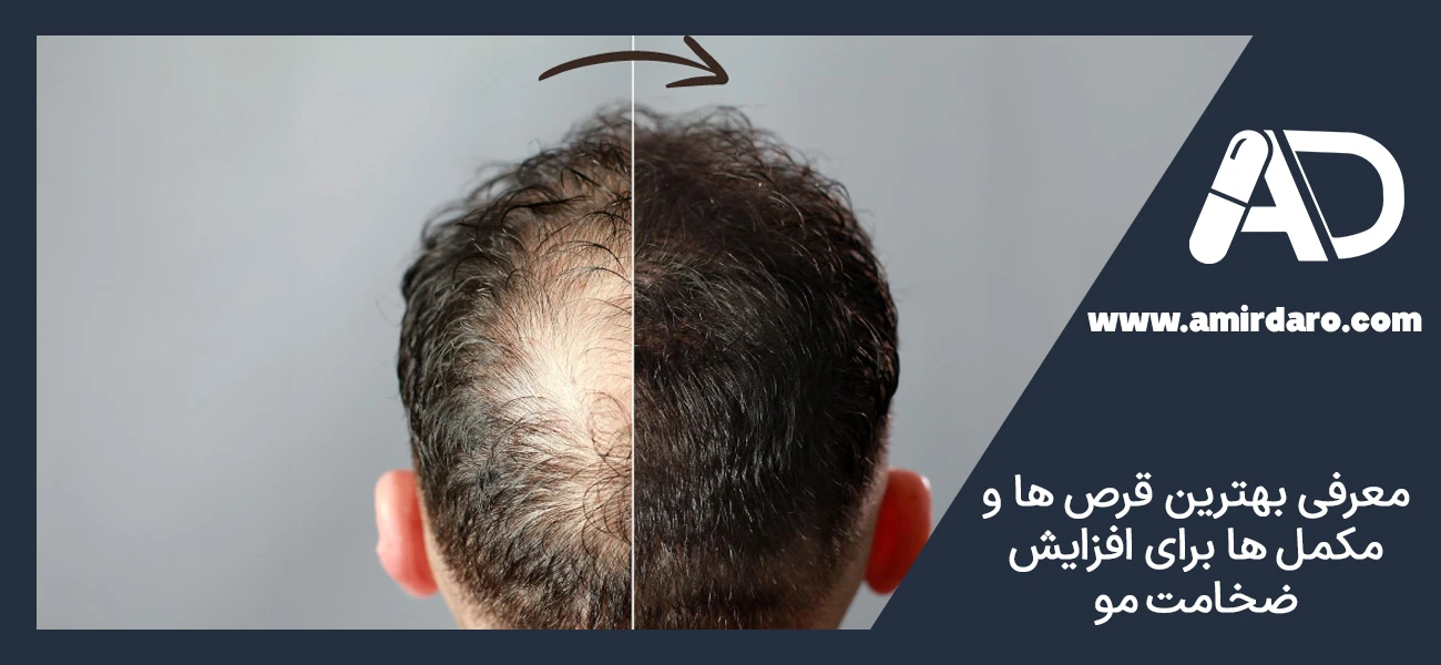 معرفی بهترین قرص‌ ها و مکمل‌ ها برای افزایش ضخامت مو