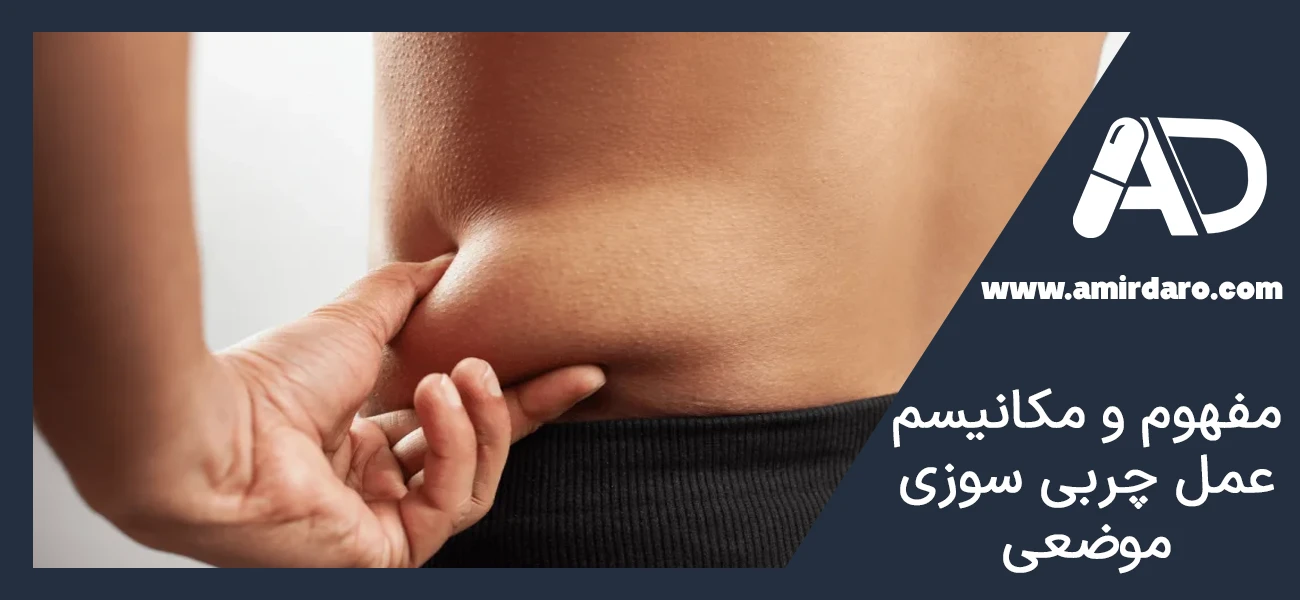 مفهوم و مکانیسم عمل چربی سوزی موضعی