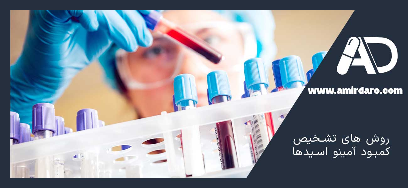 روش های تشخیص کمبود آمینو اسیدها