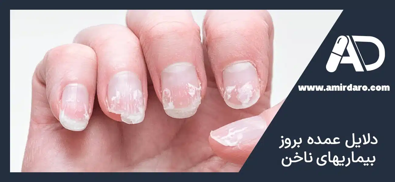 دلایل عمده بروز بیماریهای ناخن