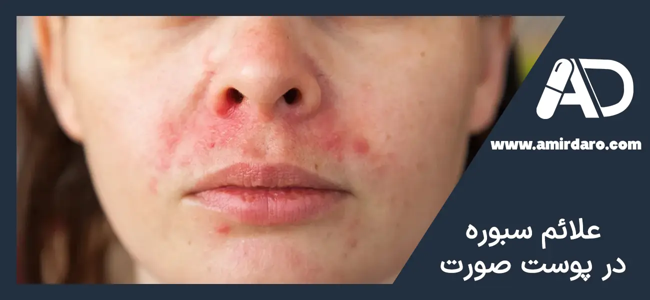 علائم سبوره در پوست صورت