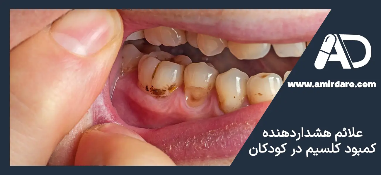 علائم کمبود کلسیم در کودکان 