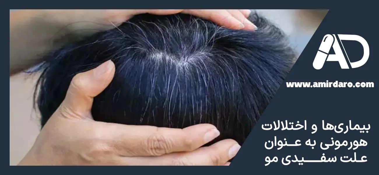 علت سفید شدن موی سر