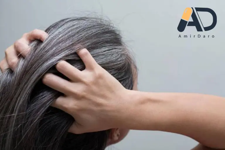 علت سفید شدن موی سر در جوانی چیست؟