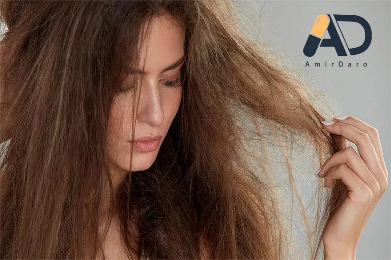 آسیب و مشکلات موی سر