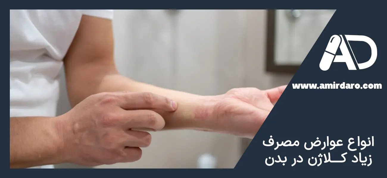 انواع عوارض مصرف زیاد کلاژن