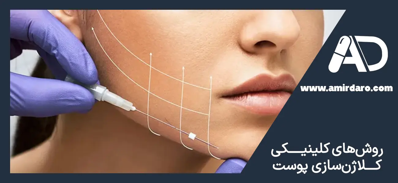 روش های کلاژن سازی پوست صورت