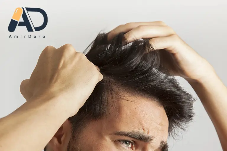 کم خونی و ریزش مو مرتبطند؟