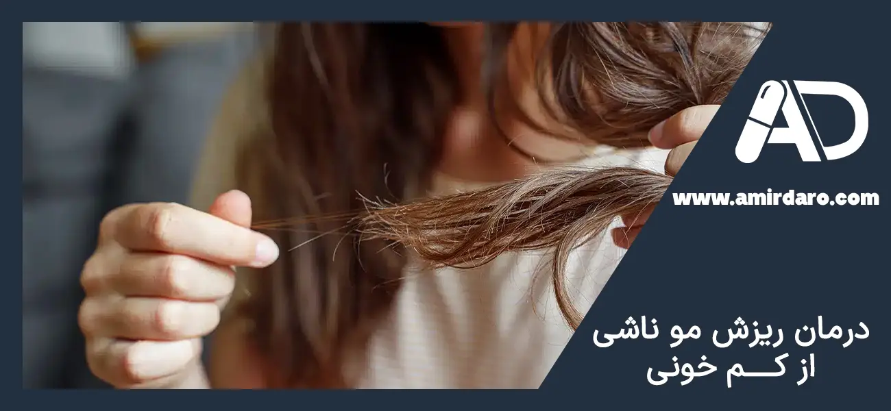 درمان ریزش موی ناشی از کم خونی