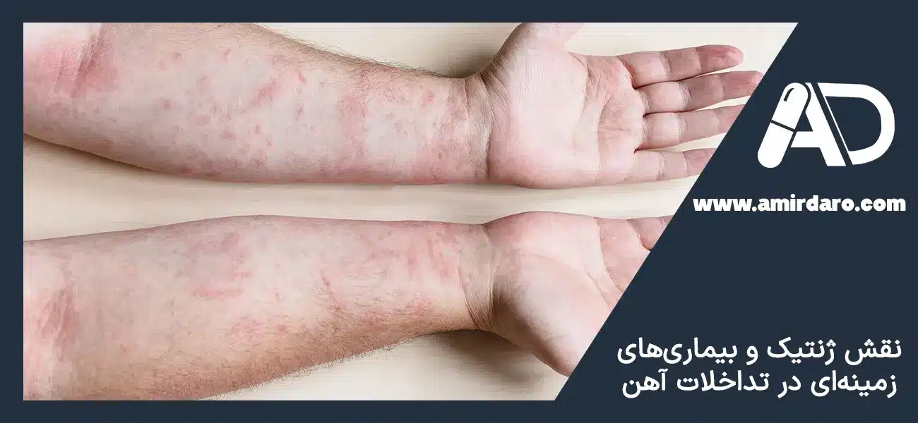 نقش بیماری ها در تداخل های مکمل آهن
