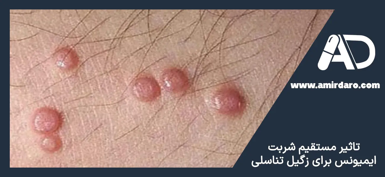 شربت ایمیونس برای زگیل تناسلی خوب است؟