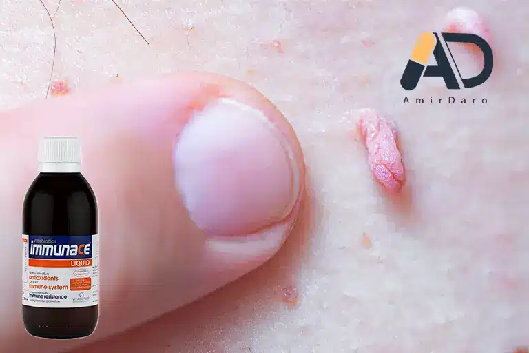 شربت ایمیونس برای زگیل تناسلی