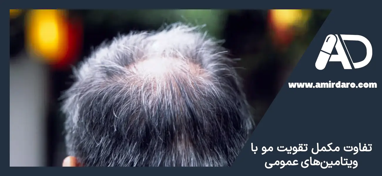 مکمل های تقویت مو