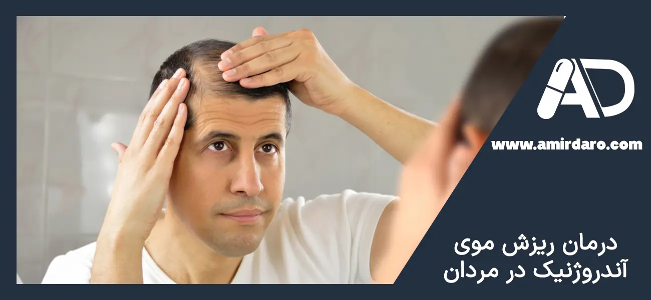درمان ریزش موی آندروژنیک در مردان 