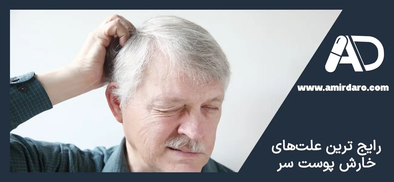 علت خارش پوست سر چیست؟