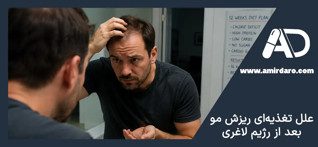 علل تغذیه‌ای ریزش مو بعد از رژیم لاغری